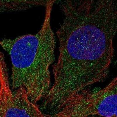 Immunocytochemistry/Immunofluorescence: DGK-delta Antibody [NBP2-58630] - Staining of human cell line U-2 OS shows localization to cytosol.