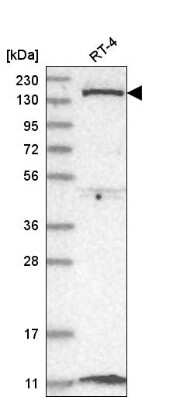 Western Blot: DGK-delta Antibody [NBP2-58630] - Analysis in human cell line RT-4.