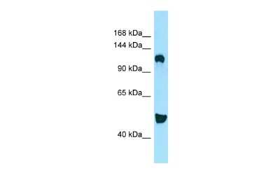 Western Blot: DGK-delta Antibody [NBP2-87266] - WB Suggested Anti-DGKD Antibody. Titration: 1.0 ug/ml. Positive Control: RPMI-8226 Whole Cell