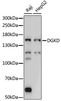 Western Blot: DGK-delta Antibody [NBP2-92207] - Analysis of extracts of various cell lines, using DGK-delta at 1:1000 dilution.Secondary antibody: HRP Goat Anti-Rabbit IgG (H+L) at 1:10000 dilution.Lysates/proteins: 25ug per lane.Blocking buffer: 3% nonfat dry milk in TBST.Detection: ECL Basic Kit .Exposure time: 5s.