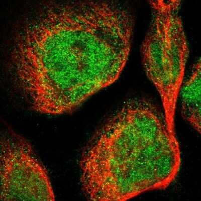 Immunocytochemistry/Immunofluorescence: DGK-epsilon Antibody [NBP1-85315] - Staining of human cell line A-431 shows positivity in nucleus but not nucleoli and cytoplasm.