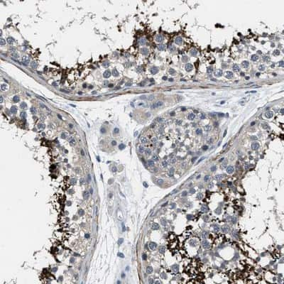 Immunohistochemistry-Paraffin: DGK-epsilon Antibody [NBP1-85315] - Staining of human testis shows distinct positivity in spermatids and spermatozoa.