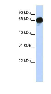 Western Blot: DGK-epsilon Antibody [NBP1-59067] - WB Suggested Anti-DGKE Antibody Titration: 0.2-1 ug/ml ELISA Titer: 1:1562500 Positive Control: Human brain