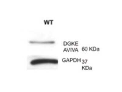 Western Blot: DGK-epsilon Antibody [NBP1-59067] - DGKE antibody - N-terminal region validated by WB using lymph at 1:1000.