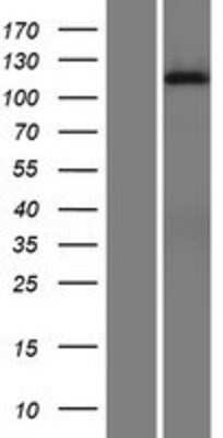 Western Blot: DGK iota Overexpression Lysate (Adult Normal) [NBP2-10536] Left-Empty vector transfected control cell lysate (HEK293 cell lysate); Right -Over-expression Lysate for DGK iota.