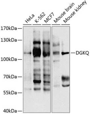 Western Blot: DGK-theta Antibody [NBP2-92780] - Analysis of extracts of various cell lines, using DGK-theta at 1:1000 dilution.Secondary antibody: HRP Goat Anti-Rabbit IgG (H+L) at 1:10000 dilution.Lysates/proteins: 25ug per lane.Blocking buffer: 3% nonfat dry milk in TBST.Detection: ECL Basic Kit .Exposure time: 30s.