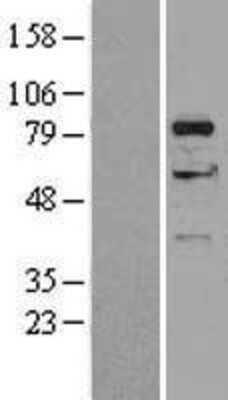 Western Blot: DGKA Overexpression Lysate (Adult Normal) [NBP2-04584] Left-Empty vector transfected control cell lysate (HEK293 cell lysate); Right -Over-expression Lysate for DGKA.