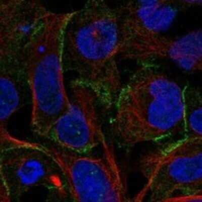 Immunocytochemistry/ Immunofluorescence DGKH Antibody - BSA Free
