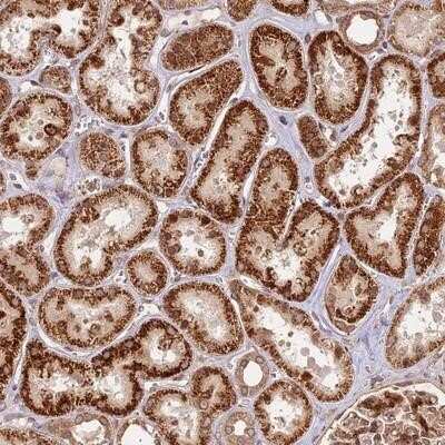 Immunohistochemistry-Paraffin: DGKH Antibody [NBP1-85228] - Staining of human kidney shows strong cytoplasmic positivity in tubule cells.