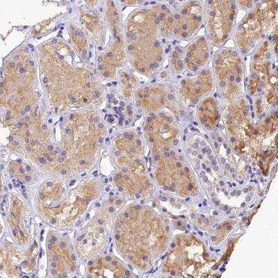 Immunohistochemistry-Paraffin: DGKH Antibody [NBP1-85229] - Staining of human kidney shows moderate cytoplasmic positivity in renal tubules.