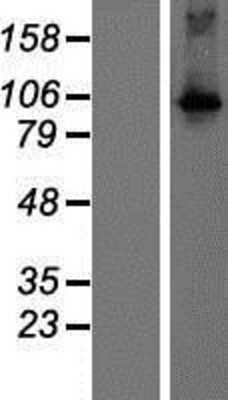 Western Blot: DGKQ Overexpression Lysate (Adult Normal) [NBP2-08216] Left-Empty vector transfected control cell lysate (HEK293 cell lysate); Right -Over-expression Lysate for DGKQ.