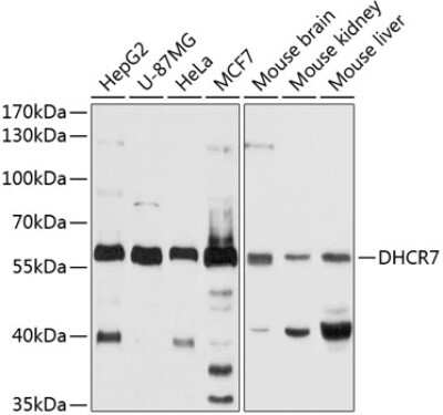 Western Blot: DHCR7 Antibody [NBP3-04053] - Analysis of extracts of various cell lines, using DHCR7 antibody at 1:1000 dilution. Secondary antibody: HRP Goat Anti-Rabbit IgG (H+L) at 1:10000 dilution. Lysates/proteins: 25ug per lane. Blocking buffer: 3% nonfat dry milk in TBST. Detection: ECL Basic Kit.