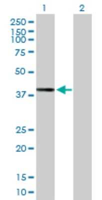 Western Blot: DHDH Antibody [H00027294-B01P] - Analysis of DHDH expression in transfected 293T cell line by DHDH polyclonal antibody.  Lane 1: DHDH transfected lysate(36.74 KDa). Lane 2: Non-transfected lysate.