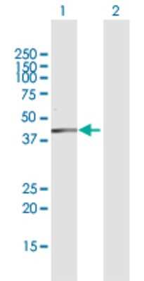 Western Blot: DHDH Antibody [H00027294-D01P] - Analysis of DHDH expression in transfected 293T cell line by DHDH polyclonal antibody.Lane 1: DHDH transfected lysate(36.40 KDa).Lane 2: Non-transfected lysate.