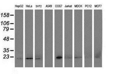 Flow Cytometry: DHFRL1 Antibody (OTI1E2) - Azide and BSA Free [NBP2-72459] - Analysis of extracts (35ug) from 9 different cell lines by using anti-DHFRL1 monoclonal antibody.