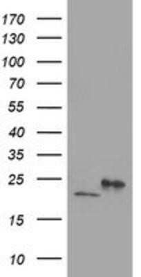 Western Blot: DHFRL1 Antibody (OTI1E2) - Azide and BSA Free [NBP2-72459] - HEK293T cells were transfected with the pCMV6-ENTRY control (Left lane) or pCMV6-ENTRY DHFRL1 (Right lane) cDNA for 48 hrs and lysed. Equivalent amounts of cell lysates (5 ug per lane) were separated by SDS-PAGE and immunoblotted with anti-DHFRL1.