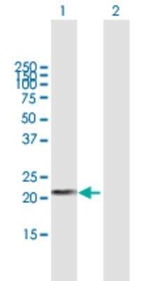Western Blot: DHFRL1 Antibody [H00200895-B01P] - Analysis of DHFRL1 expression in transfected 293T cell line by DHFRL1 polyclonal antibody.  Lane 1: DHFRL1 transfected lysate(20.57 KDa). Lane 2: Non-transfected lysate.