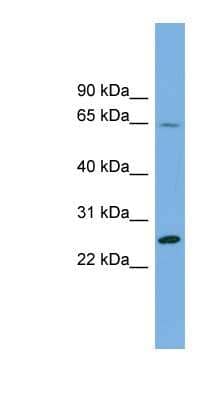 Western Blot: DHFRL1 Antibody [NBP1-55510] - THP-1 cell lysate, concentration 0.2-1 ug/ml.