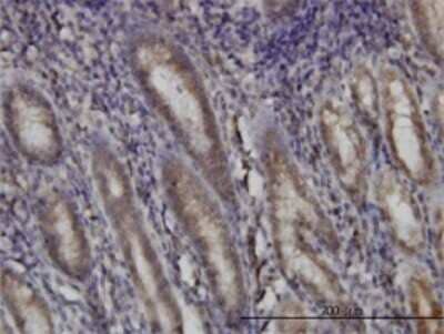 Immunohistochemistry-Paraffin: DHODH Antibody (6E1) [H00001723-M01] - Analysis of monoclonal antibody to DHODH on formalin-fixed paraffin-embedded human stomach. Antibody concentration 3 ug/ml.