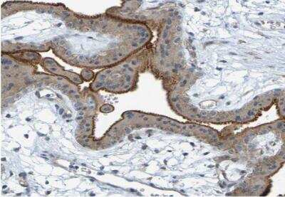 Immunohistochemistry-Paraffin: DHODH Antibody [NBP1-86097] - Staining of human placenta shows strong cytoplasmic granular positivity in trophoblastic cells.