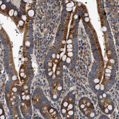 Immunohistochemistry-Paraffin: DHODH Antibody [NBP1-86110] - Staining of human duodenum shows moderate cytoplasmic positivity in glandular cells.