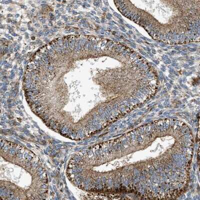 Immunohistochemistry-Paraffin: DHODH Antibody [NBP1-86110] - Staining of human endometrium shows moderate cytoplasmic positivity in glandular cells.