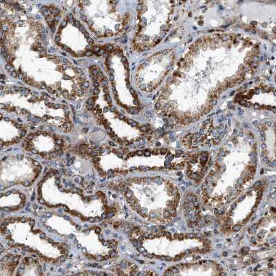 Immunohistochemistry-Paraffin: DHODH Antibody [NBP1-86110] - Staining of human kidney shows moderate cytoplasmic positivity in cells in tubules.