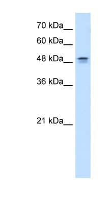 Western Blot: DHODH Antibody [NBP1-59584] - HepG2 cell lysate, concentration 0.2-1 ug/ml.