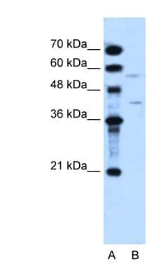 Western Blot: DHODH Antibody [NBP1-59591] - HepG2 cell lysate, concentration 2.5 ug/ml.