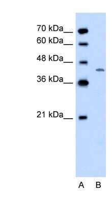 Western Blot: DHODH Antibody [NBP1-59593] - Jurkat cell lysate, concentration 0.2-1 ug/ml.