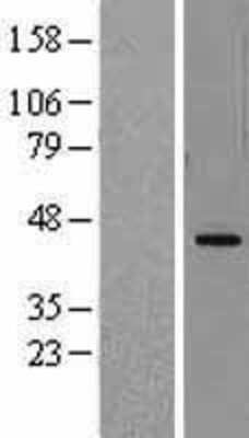 Western Blot: DHODH Overexpression Lysate (Adult Normal) [NBL1-09863] Left-Empty vector transfected control cell lysate (HEK293 cell lysate); Right -Over-expression Lysate for DHODH.