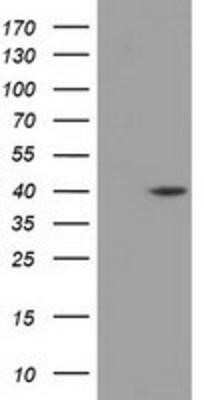 Western Blot: DHPS Antibody (OTI2C9) - Azide and BSA Free [NBP2-70570] - HEK293T cells were transfected with the pCMV6-ENTRY control (Left lane) or pCMV6-ENTRY DHPS (Right lane) cDNA for 48 hrs and lysed. Equivalent amounts of cell lysates (5 ug per lane) were separated by SDS-PAGE and immunoblotted with anti-DHPS.