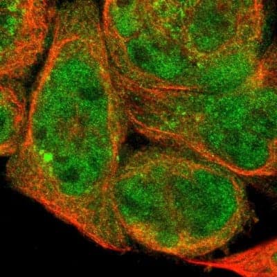 Immunocytochemistry/Immunofluorescence: DHRS1 Antibody [NBP1-83560] - Staining of human cell line A-431 shows localization to nucleoplasm, cytosol & centrosome. Antibody staining is shown in green.