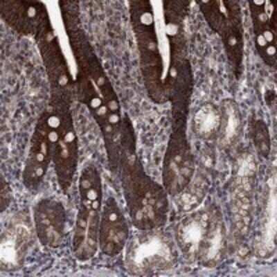 Immunohistochemistry-Paraffin: DHRS1 Antibody [NBP3-17027] - Staining of human duodenum shows strong cytoplasmic positivity in glandular cells.