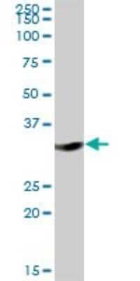 Western Blot DHRS1 Antibody - Azide and BSA Free
