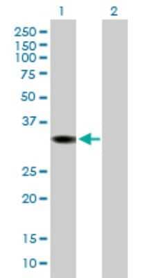 Western Blot: DHRS1 Antibody [H00115817-B01P] - Analysis of DHRS1 expression in transfected 293T cell line by DHRS1 polyclonal antibody.  Lane 1: DHRS1 transfected lysate(34.43 KDa). Lane 2: Non-transfected lysate.