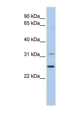 Western Blot: DHRS1 Antibody [NBP1-56415] - 721_B cell lysate, concentration 0.2-1 ug/ml.
