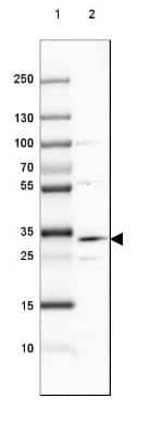Western Blot: DHRS1 Antibody [NBP1-83560] - Lane 1: Marker [kDa] 250, 130, 100, 70, 55, 35, 25, 15, 10Lane 2: Human Cerebral Cortex tissue