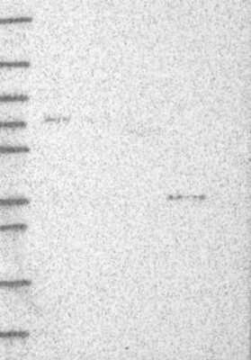 Western Blot DHRS1 Antibody - BSA Free