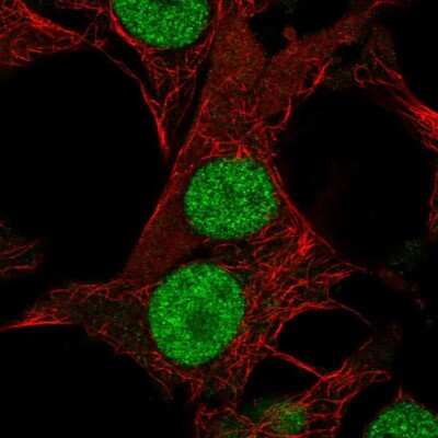 Immunocytochemistry/ Immunofluorescence DHRS12 Antibody