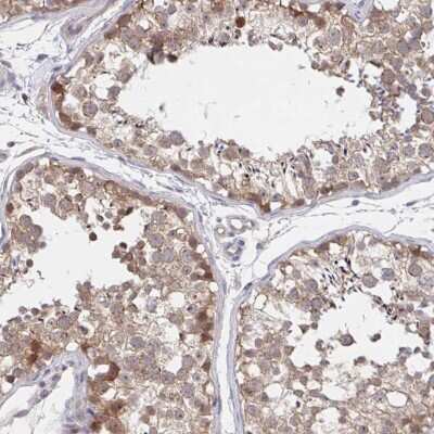 Immunohistochemistry-Paraffin DHRS12 Antibody