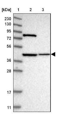 Western Blot DHRS13 Antibody - BSA Free