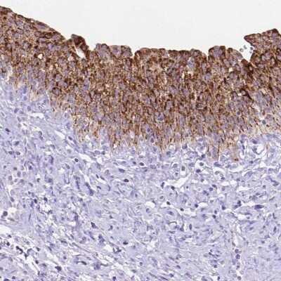 Immunohistochemistry-Paraffin: DHRS2 Antibody [NBP2-49605] - Staining of human urinary bladder shows strong cytoplasmic positivity in urothelial cells.