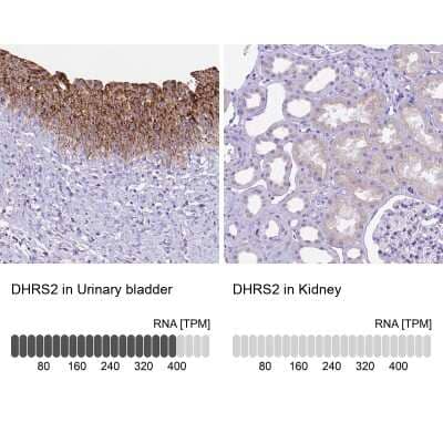 Immunohistochemistry-Paraffin: DHRS2 Antibody [NBP2-49605] - Staining in human urinary bladder and kidney tissues using anti-DHRS2 antibody. Corresponding DHRS2 RNA-seq data are presented for the same tissues.
