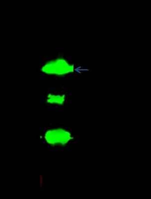 Immunoprecipitation: DHRS2 Antibody [NBP2-99117] - DHRS2 was immunoprecipitated using: Lane A: 0.5 mg Jurkat Whole Cell Lysate. Lane B: 0.5 mg A431 Whole Cell Lysate. Lane C: 0.5 mg 293T Whole Cell Lysate4 ul anti-DHRS2 rabbit polyclonal antibody and 15 ul of 50 % Protein G agarose. Primary antibody: Anti-DHRS2 rabbit polyclonal antibody, at 1:100 dilution. Secondary antibody: Dylight 800-labeled antibody to rabbit IgG (H+L), at 1:5000 dilution. Developed using the Odyssey technique. Performed under reducing conditions. Predicted band size: 31 kDa. Observed band size: 26 kDa