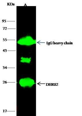 Immunoprecipitation: DHRS2 Antibody [NBP3-12781] - Lane A:0.5 mg Jurkat Whole Cell LysateLane B:0.5 mg A431 Whole Cell LysateLane C:0.5 mg 293T Whole Cell Lysate4 uL anti-DHRS2 rabbit polyclonal antibody and 15 ul of 50 % Protein G agarose.Primary antibody:Anti-DHRS2 rabbit polyclonal antibody,at 1:100 dilution Secondary antibody:Dylight 800-labeled antibody to rabbit IgG (H+L), at 1:5000 dilution Developed using the odssey technique.Performed under reducing conditions.Predicted band size: 31 kDaObserved band size: 26 kDa