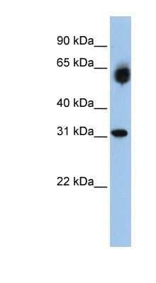 Western Blot: DHRS2 Antibody [NBP1-54922] - Titration: 0.2-1 ug/ml, Positive Control: 721_B cell lysate.