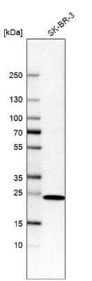 Western Blot: DHRS2 Antibody [NBP2-56196] - Analysis in human cell line SK-BR-3.