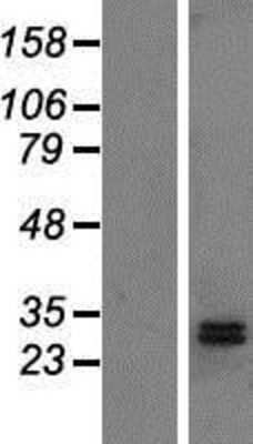Western Blot: DHRS2 Overexpression Lysate (Adult Normal) [NBP2-04800] Left-Empty vector transfected control cell lysate (HEK293 cell lysate); Right -Over-expression Lysate for DHRS2.