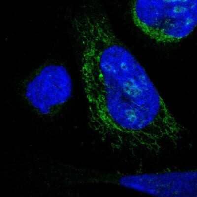 Immunocytochemistry/ Immunofluorescence DHRS3 Antibody